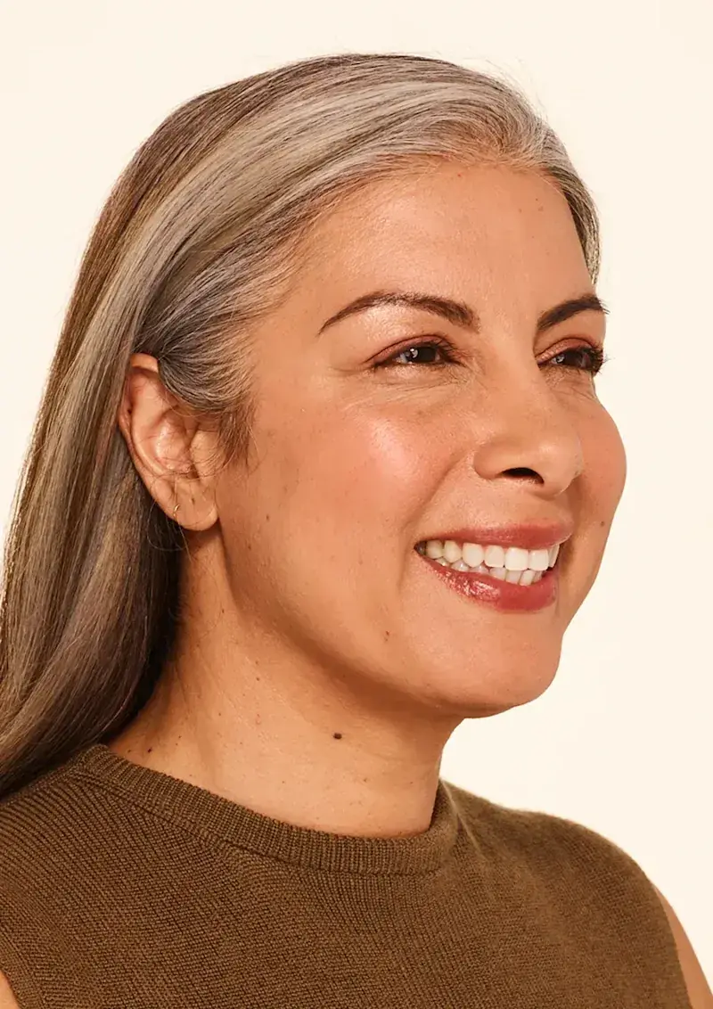 30 days after BOTOX Cosmetic treatment, Allergan Aesthetics manufacturer clinical photo