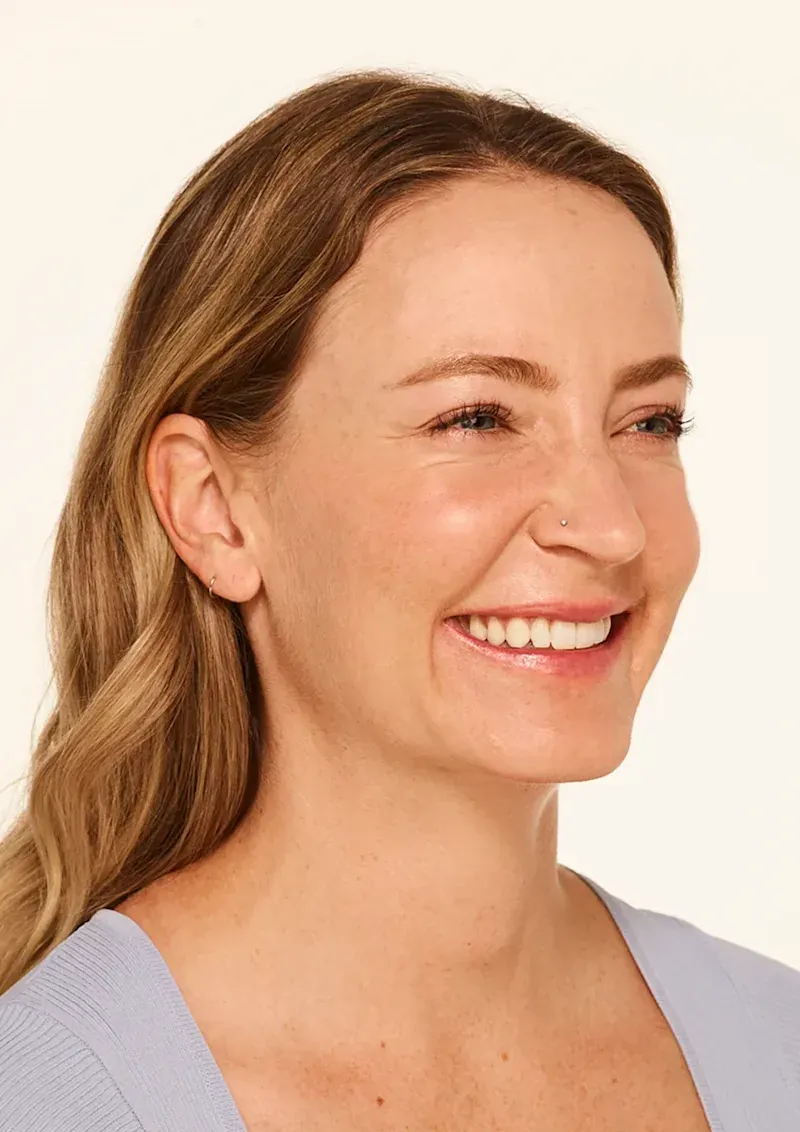 Before BOTOX Cosmetic treatment, Allergan Aesthetics manufacturer clinical photo