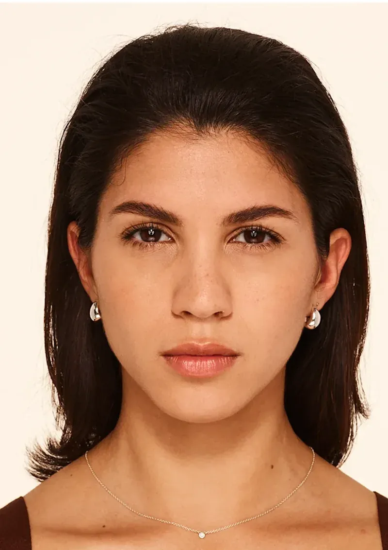 30 days after BOTOX Cosmetic treatment, Allergan Aesthetics manufacturer clinical photo