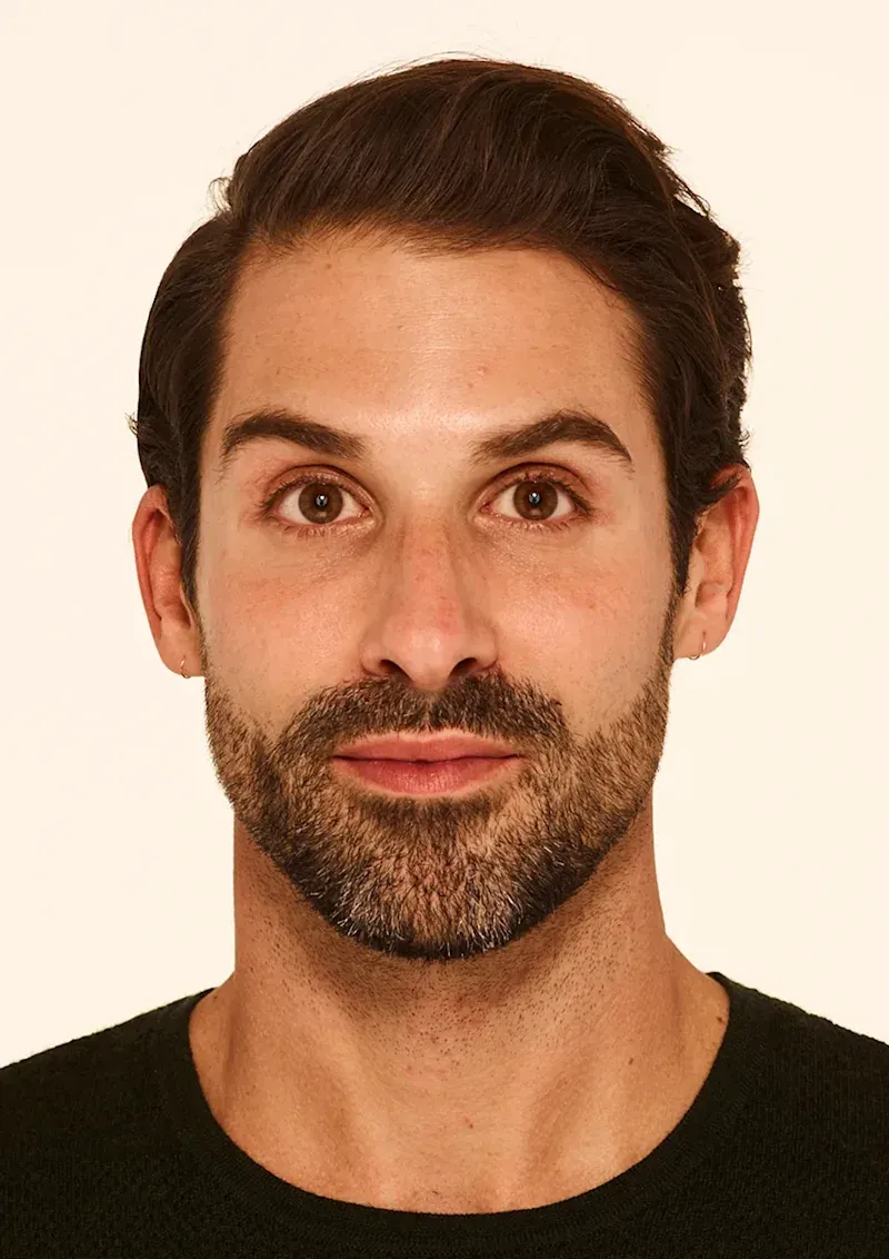 30 days after BOTOX Cosmetic treatment, Allergan Aesthetics manufacturer clinical photo